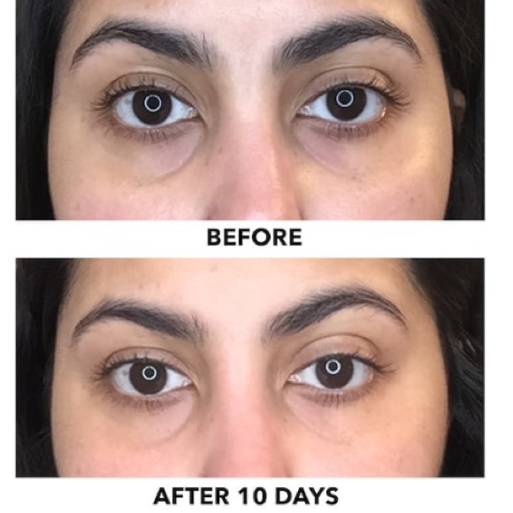 ALGENIST TRIPLE ALGAE EYE RENEWAL BALM - Picture 5 of 12